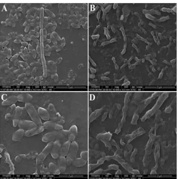 Fig 7. Scanning electron microscopy of biofilm formation: (A) Biofilm formation of control consortium cells under dark condition (B) Interacted biofilm formation at 1 μg/ml TiO 2 -NPs under dark condition (C) Biofilm formation of control consortium under U