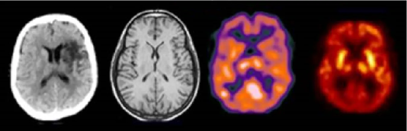 Figure 2.1: Transaxial slice of the human brain acquired with different imaging modalities.