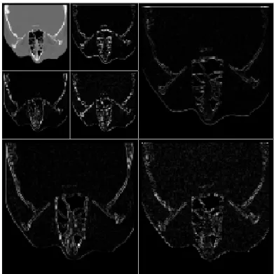 Figure 2.3: Example of a wavelet transform applied to a slice of CT_skull, obtained with MATLAB.