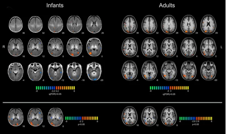 Fig 4. Multi-subject GLM analysis for coherent versus random flow motion stimuli. Results of a multi-subject fixed-effect general linear model (FFX-GLM) analysis for the BOLD response to coherent versus random flow motion performed on the group of 11 infan
