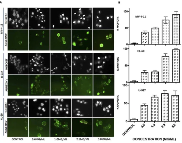 Figure 1. DRE induces apoptosis in CMML cells in a dose dependent manner. MV-4-11, HL-60 and U-937 cells were treated with increasing doses of DRE and analyzed for the induction of apoptosis