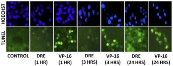Figure 3. DRE reduces the viability of MV-4-11 cells in a time dependent manner. (a). MV-4-11 cells were plated in 96-well clear bottom plates and treated with DRE at indicated time points and analyzed for the ability of DRE to reduce the viability of thes