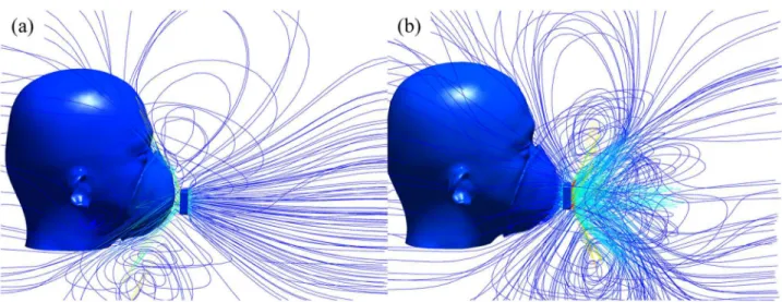 Fig 5. Streamline distribution around the object's head when the FFR with a ventilation fan