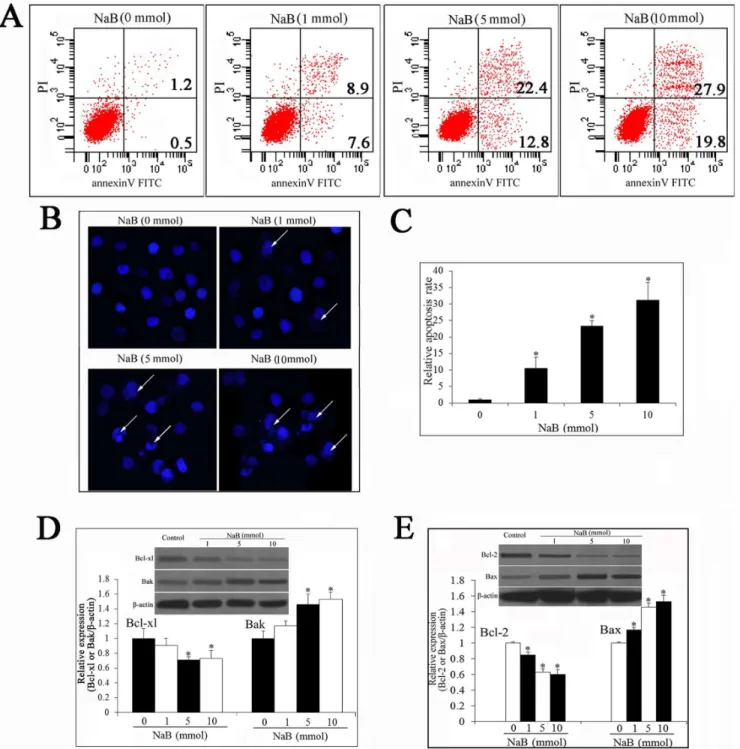 Figure 2. NaB treatment induces apoptosis of DU145 cells in a dose-dependent manner. (A) Flow cytometry analysis of NaB treated DU145 cells stained with annexin V and PI