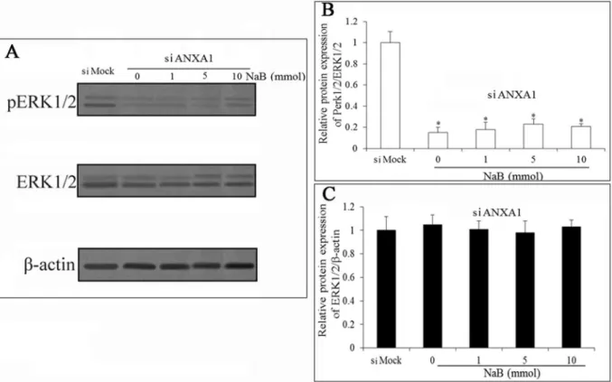 Figure 5. ANXA1 knockdown inhibits ERK activation. The expression of p-ERK and ERK are detected by western blot analysis