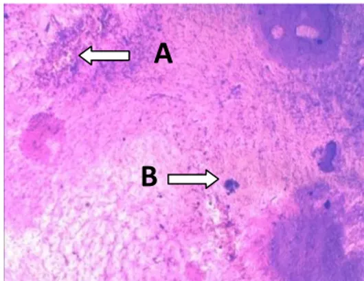 Figure 1. Photomicrograph scan of a coronal section  (50 µm) showing the correct place of injection into  SNC