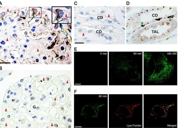 Figure 1. Uptake of recombinant a -Gal A by human podocytes. (A) Peroxidase immunohistochemistry for a-Gal A in a biopsy from a male Fabry patient using anti-human a-Gal A antibody