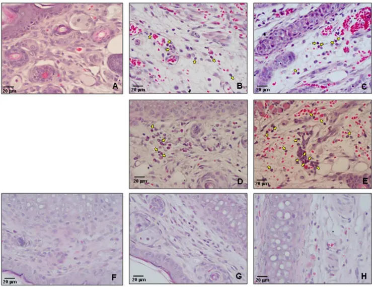 Figure 3. Histopathological changes at the mosquito bite and CHIKV injected sites. Biopsies obtained from mouse ear samples were fixed in 10% neutral formalin and paraffin embedded