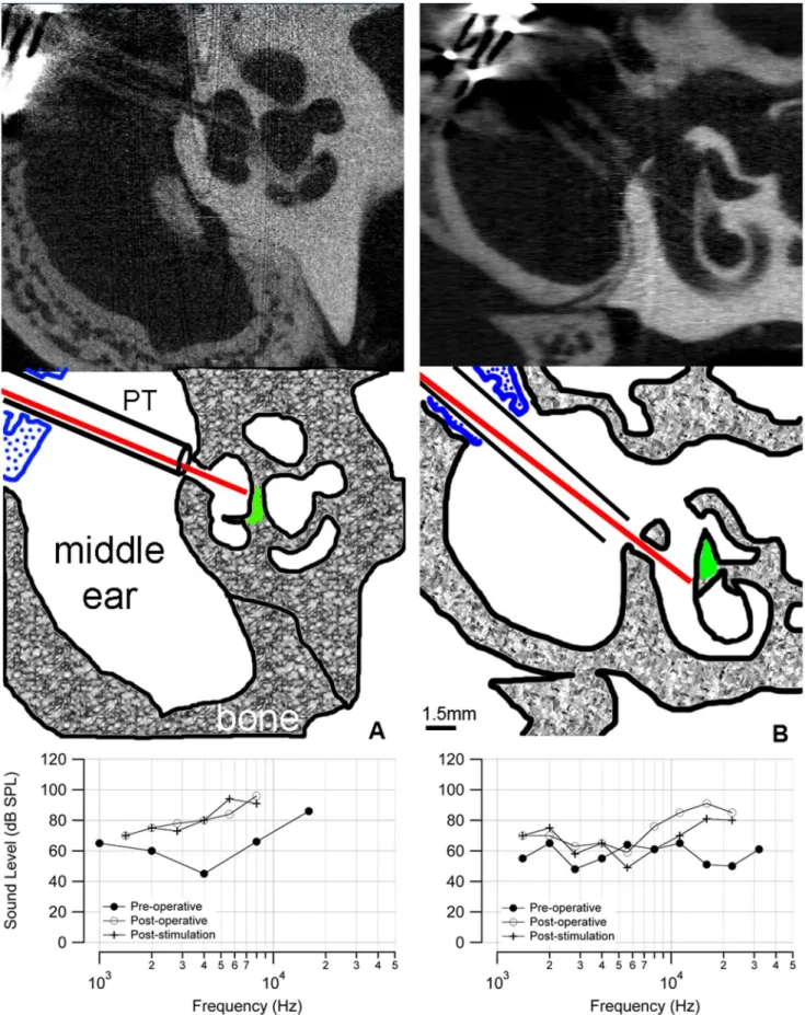 Figure 6. microCT images of chronically implanted cat cochleae. (a) A microCT image of a stimulated cat cochlea shows the placement of the optical fiber