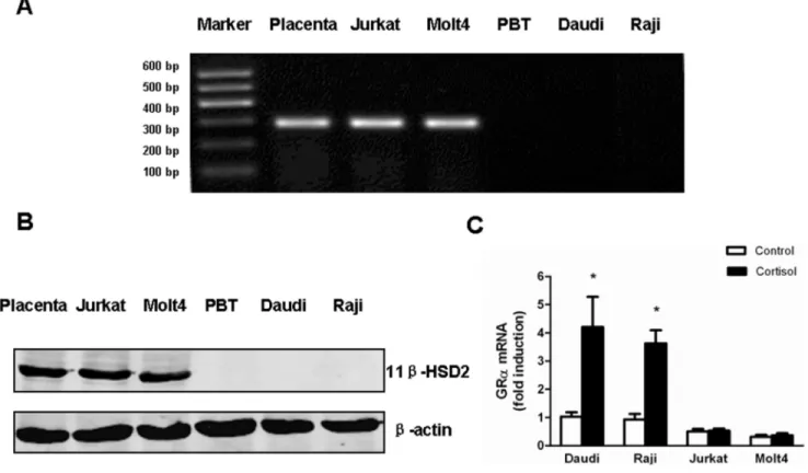 Figure 2. Jurkat and Molt4 cells express high expression of 11b-HSD2 and fail to auto-induce GRa after cortisol treatment