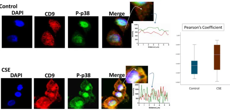 Fig 5. Colocalization of exosome marker H3 and CD9 in AECs. Immunofluorescence imaging of control (top panel) and CSE treated amnion cells (bottom panel) show colocalization differences of H3 (green) and CD9 (red)