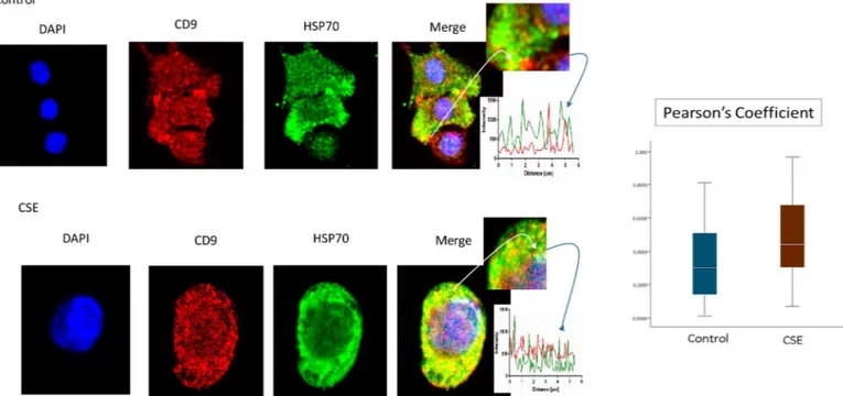 Fig 7. Colocalization of exosome marker P-p38MAPK and CD9 in AECs. Colocalization of pro-senescence marker P-p38MAPK and CD9: