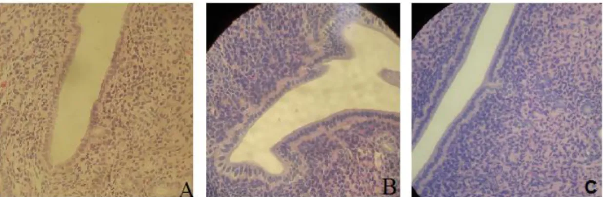 Figura 2: Fotomicrografias do estroma endometrial (40x). A – grupo controle; B – grupo E;  