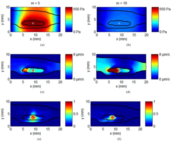 Figure 10. Variation of tracer distribution volumes in tissue with infusion volume for the whole leg and tumor following CED (0.3 mL/min) at the center of the tumor for varying values of the hydraulic conductivity parameter, m