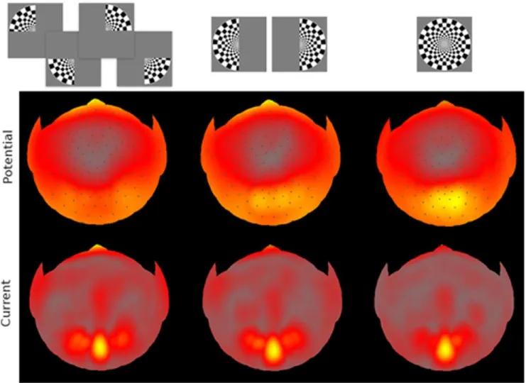 Figure 3 shows averaged VEP epochs at a mid-occipital, O z , site (top row) and a mid-frontal-pole, F pz , sites (bottom row)
