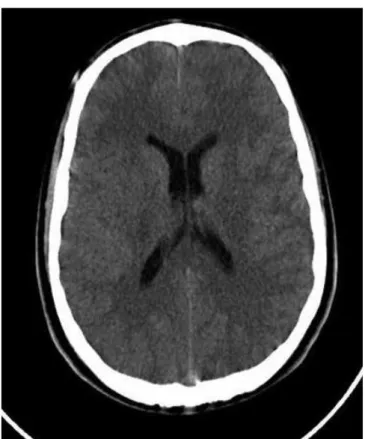 Figure 1. An initial BCT scan normal indings