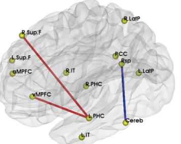 Fig 1. Significantly different DMN functional connectivity between APOE ε 4 ε 3 and ε 3 ε 3