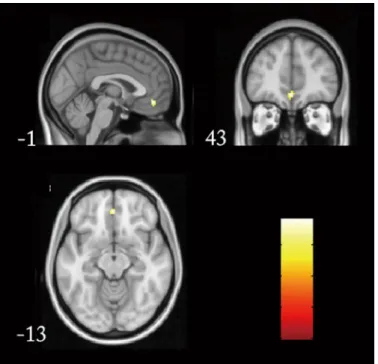 Fig 3. Whole brain functional connectivity by taking LPHC as a seed region. Significantly increased functional connectivity presented in medial prefrontal cortex (cluster size = 20, p = 0.005) in APOE ε 4 carriers were presented from different directions.