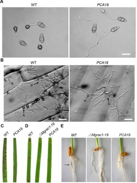 Figure 7. Chm1 D PBD rescues conidiation in Mgrac1 deletion mutants. (A) DIC microscopy of conidia of WT (70-15) and PCA19 (Chm1D PBD expression in the Mgrac1 deletion mutant) collected after incubation the hydrophobic Gelbond film surface