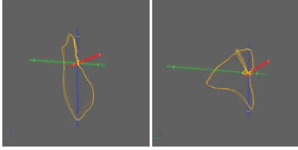 Figure 4 Example of two 3D vectorcardiograms exported by the SaveU3D module. Shows the same 5-beat vectorcardiograms as Fig