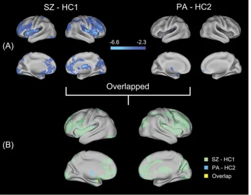 Figure 1. Surface renderings representing the results from the analysis of structural MRI data