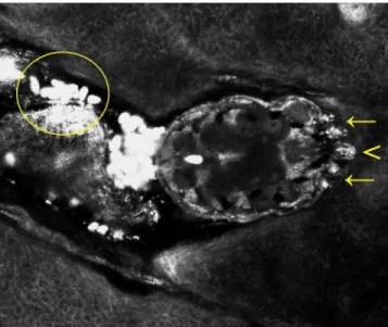 Fig 4. Sarcoptes scabiei observed at the end of a burrow by handheld confocal microscopy