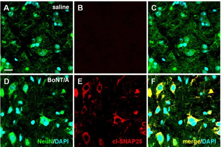 Figure 4. Immunofluorescence detection of cl-SNAP-25 in DRG. Representative examples of high magnification confocal images taken from section of DRG in naı¨ve mice injected with saline (panels A-C) or BoNT/A (panels D-F; 15 pg/paw)