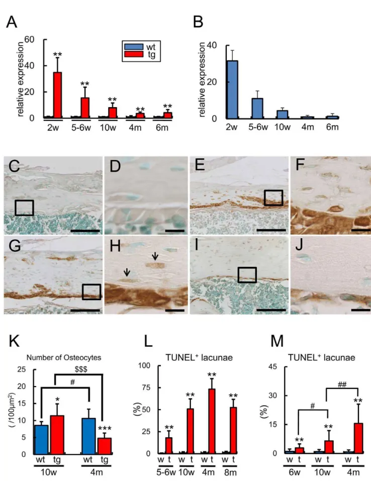 Figure 2. Transgene expression, osteocyte number, and the frequencies of TUNEL-positive lacunae
