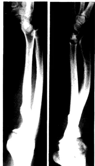 Fig. 3 — Radiografias mostrando as alterações típicas do antebraço e punho. 