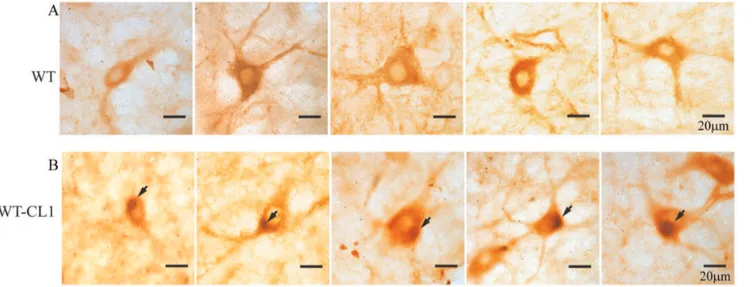 Figure 8. Formation of Lewy body-like aggregates in neurons in the SNc expressing WT-CL1 a -syn