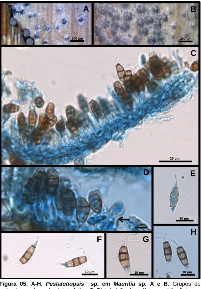 Figura  05.  A-H.  Pestalotiopsis    sp.  em  Mauritia  sp.  A  e  B.  Grupos  de  acérvulos na face abaxial da folha