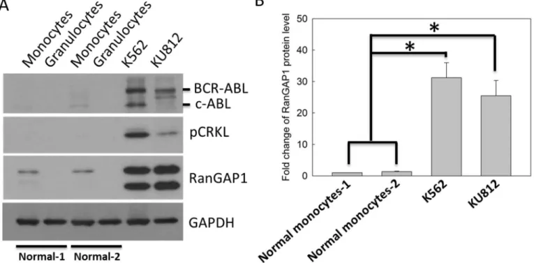 Fig 1. RanGAP1 protein level was increased in CML cells compared with that in normal cells
