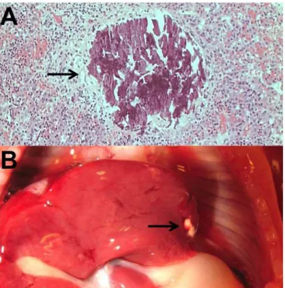 Fig 1. Fetal liver calcification seen on histological section (A) and macroscopically (B)