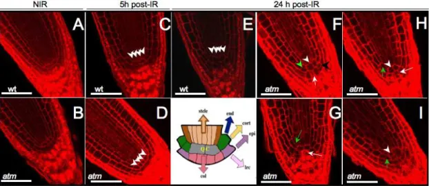 Figure 2. CLSM optical longitudinal sections of WT and atm stem cells and QC post-IR. Arrowheads point to QC cells and arrows on columella initials