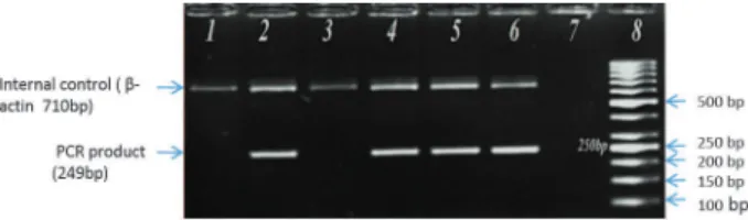 Fig. 1. Agarose gel electrophoretogram shows the detection of  MTHFR 677C > T polymorphism by ARMS-PCR technique.