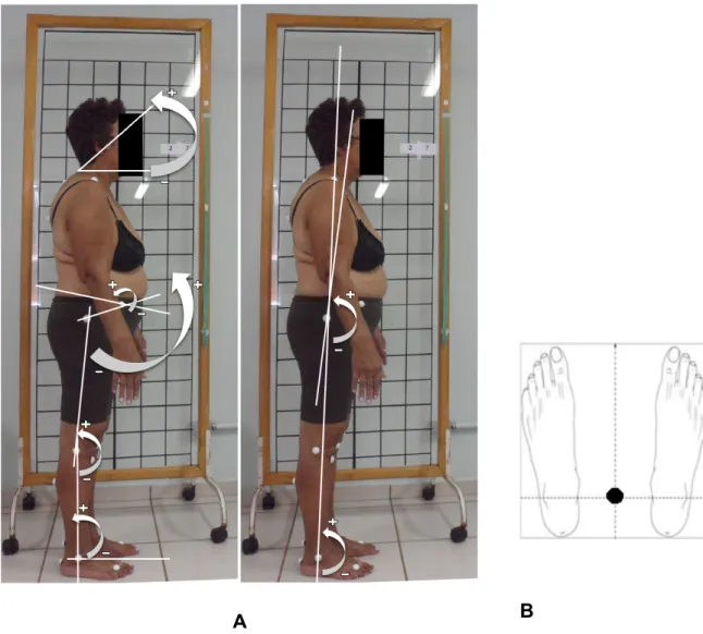 Figure 1. A: Reference points used for postural analysis in the sagittal plane.  Testing was carried 