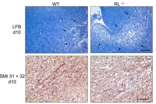 Figure 6. RNase L mitigates spinal cord demyelination. Spinal cords of infected wt and RL 2/2 mice at day 7 (top) and day 10 (bottom) p.i.