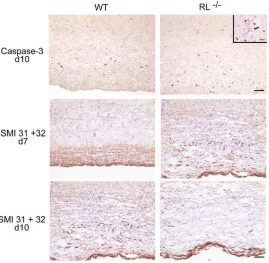Figure 7. RNase L regulates apoptosis and ameliorates axonal degeneration. Immunohistochemical staining for activated caspase-3 (top panels) at day 10 p.i
