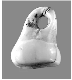 Fig. 4 - Dent humaine perforée (ensemble supérieur); 