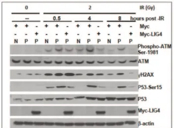 Figure S1 CoDa cells have normal RAD51and phos- phos-phorylated DNA-PKcs focus formation