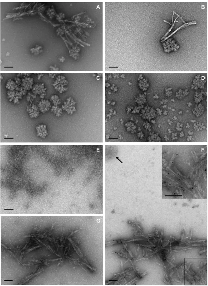 Figure 7. The ultrastructure of rPrP-res is fibrillar and not granular. Transmission electron microscopy by negative stain techniques was used to examine rPrP-res (A, B), unsonicated PMCA substrate (C), mouse liver extract alone (D), and mouse liver extrac