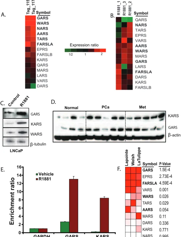 Figure 5. Androgen dependent up-regulation of aminoacyl tRNA synthetases in LNCaP, and their expression in prostate cancer
