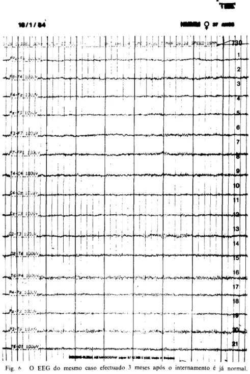 Fig. 6 O EEG do mesmo caso efectuado 3 meses após o internamento é já normal. 