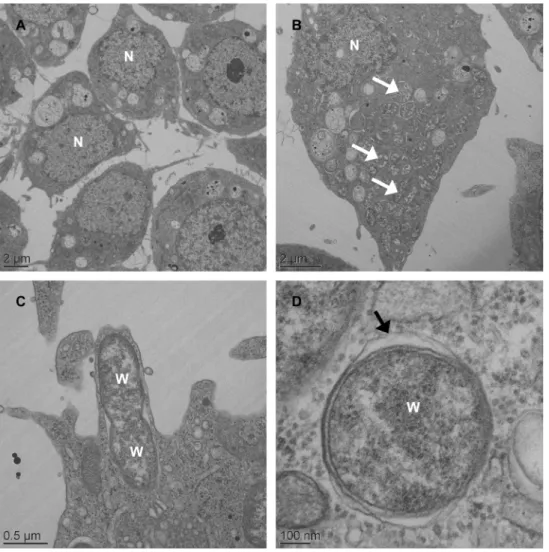 Fig 1. Electron microscopy of Wolbachia in Aedes albopictus C6/36 cells. Low-magnification transmission electron micrograph of C6/36_TET cells with no bacterial signal in host cell cytoplasm (A) whereas Wolbachia (white arrowhead) are seen throughout the c