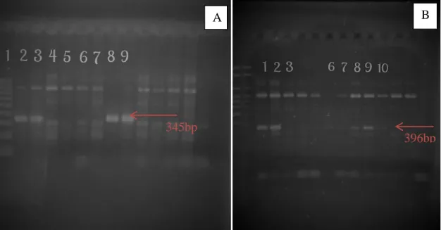 Figura  2  Eletroforese em  gel  de  agarose  2%  corado  com  brometo  de  etídio  mostrando  os  resultados  da PCR para  família Anaplasmataceae e para E