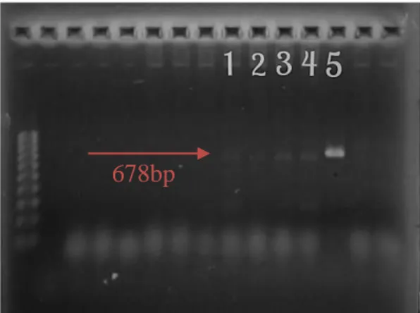 Figura 3 Eletroforese em gel agarose corado com brometo de etídio mostrando o resultado da PCR  para  A