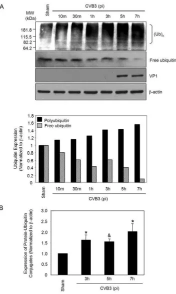 Figure 3. Knockdown of ubiquitin expression by siRNA reduces CVB3 replication. HeLa cells were transiently transfected with the ubiquitin siRNA or a scramble control siRNA