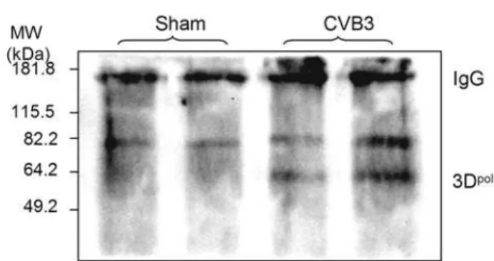 Figure 5. CVB3 RNA-dependent RNA polymerase 3D is ubiquitinated. HeLa cells were infected with CVB3 or sham-infected with PBS for 7 h, Cell lysates were collected and immuoprecipitated (IP) with a monoclonal anti-ubiquitin antibody