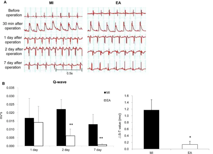 Figure 1. Effects of EA treatment on ECG recording of MI heart. ECG was continuously monitored before, during and after myocardial ischemia
