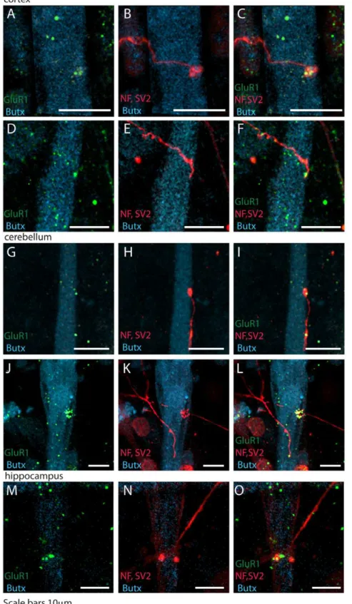 Figure 2. Glutamatergic neurons from different brain areas form synaptic contacts with myotubes in vitro